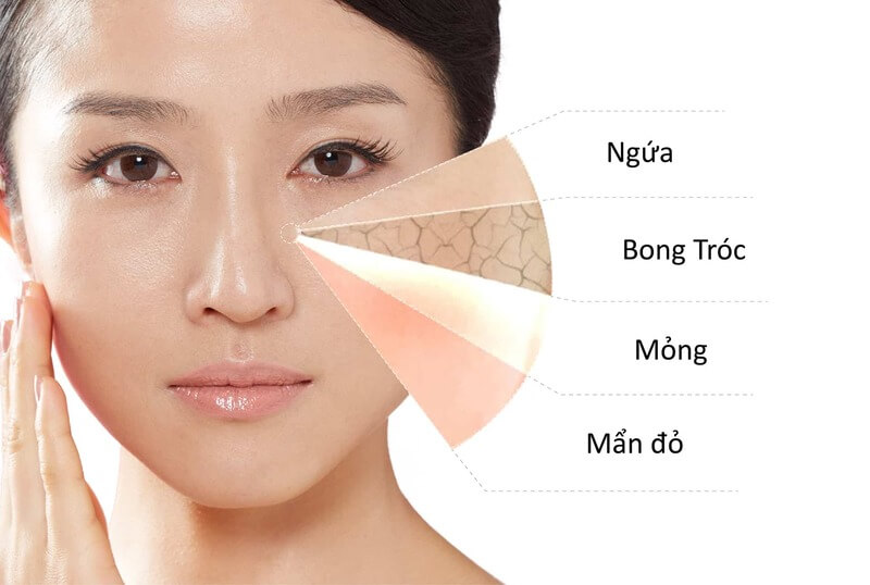 Da khô là gì ? Nguyên nhân, biểu hiện và cách chăm sóc 3 Biểu hiện của da khô