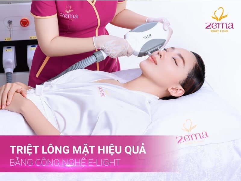 Dịch vụ triệt lông mặt