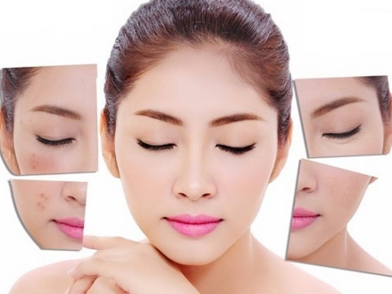 Peel da là gì ? Những thông tin cần biết về peel da 2 Peel mang lại rất nhiều tác dụng tốt cho da