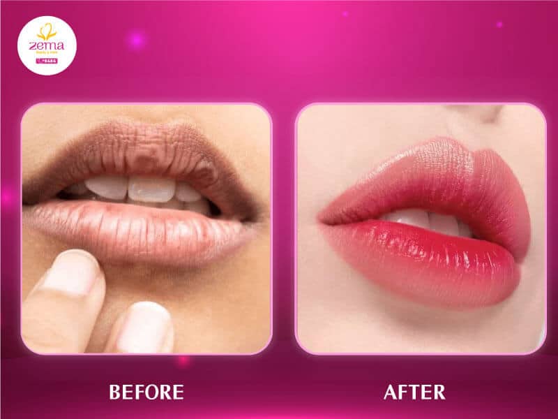 Chăm sóc môi sau phun: 5 bước để lên màu đẹp 2 Chăm sóc môi sau phun để lên màu đẹp