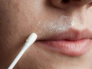 Da quanh miệng bị khô: Nguyên nhân và cách khắc phục