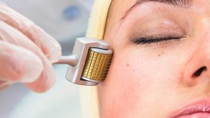 Sau lăn kim nên và không nên ăn gì ?