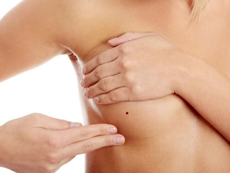 Ý nghĩa những nốt ruồi ở ngực ai nghe xong cũng thấy bất ngờ 2 Trong tướng số nốt ruồi ở ngực có ý nghĩa tốt hay xấu còn tùy thuộc vị trí mọc cụ thể