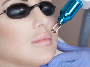 4 cách xử lý xăm viền môi đậm giúp lấy lại đôi môi đều màu cho chị em 9 4 cách xử lý xăm viền môi đậm giúp lấy lại đôi môi đều màu cho chị em
