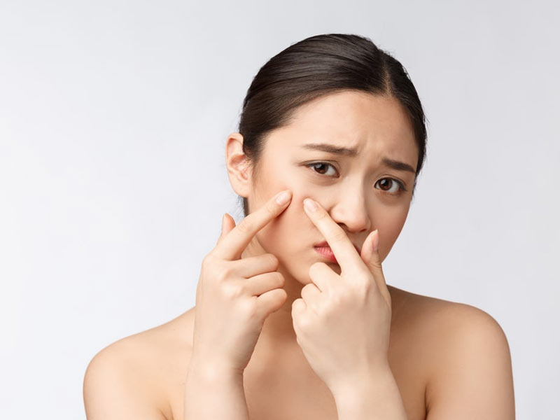 Có nên đi spa trị mụn không? Nên chọn Spa như thế nào để trị mụn hiệu quả 2 Trị mụn ngay tại nhà và những điều cần biết