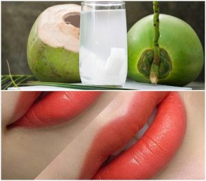 Phun môi uống nước dừa được không? Có lợi hay gây hại cho môi? 10 Phun môi uống nước dừa được không? Có lợi hay gây hại cho môi?