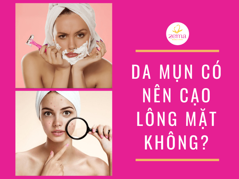 Góc Giải đáp Thắc Mắc: Làn Da Mụn Có Nên Cạo Lông Mặt Không? - Zema Spa