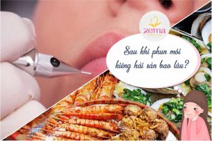 Sau phun môi kiêng hải sản bao lâu và những điều cần lưu ý 9 Sau phun môi kiêng hải sản bao lâu và những điều cần lưu ý