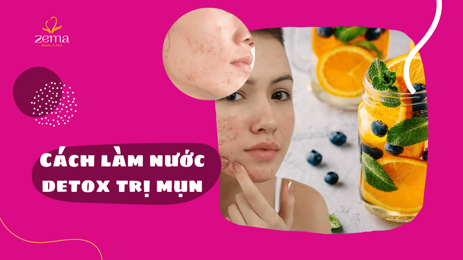Nước detox là gì? Gợi ý 3 cách làm nước detox trị mụn đơn giản 7 Nước detox là gì? Gợi ý 3 cách làm nước detox trị mụn đơn giản