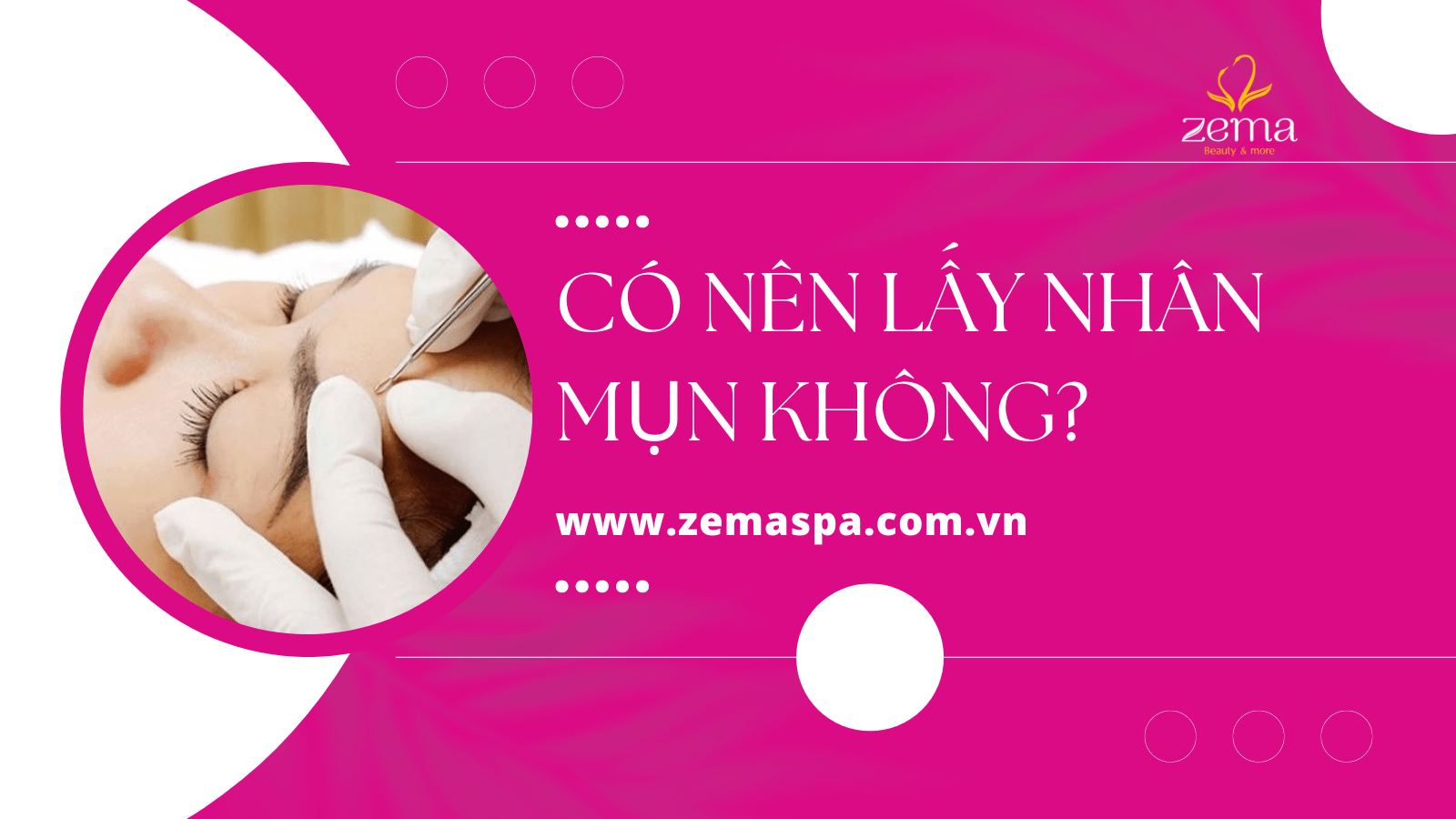 Có nên lấy nhân mụn không? Muốn lấy nhân mụn an toàn phải làm sao? 6 Có nên lấy nhân mụn không? Muốn lấy nhân mụn an toàn phải làm sao?