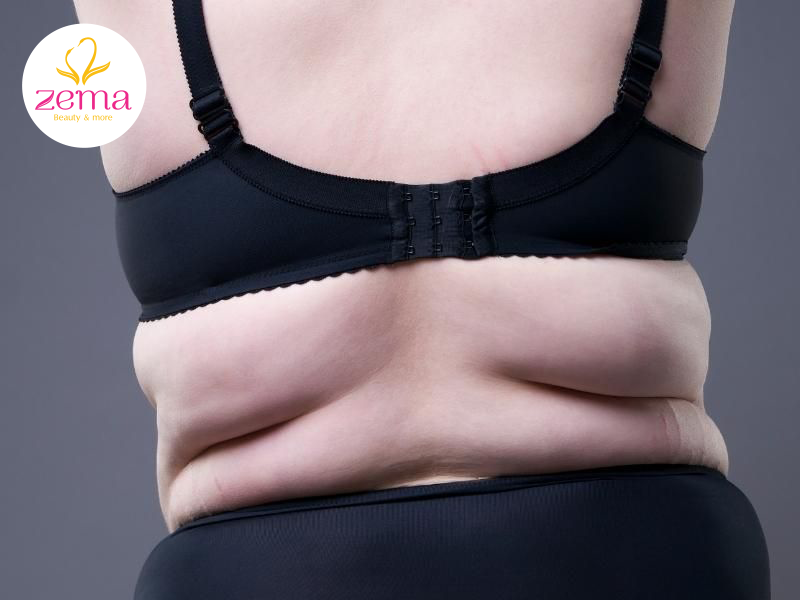 Bí quyết giảm mỡ lưng đơn giản có thể áp dụng ngay tại nhà 1 Càng ít vận động lượng mỡ thừa tích tụ ở lưng càng lớn