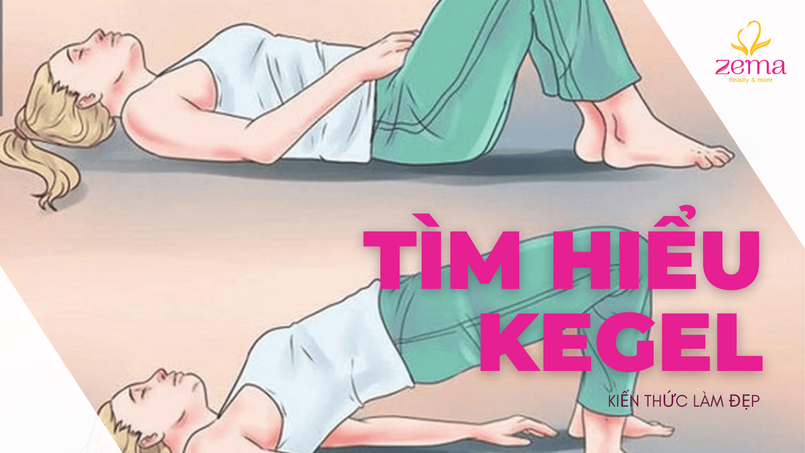 Kegel là gì? Tập kegel mang đến lợi ích gì cho cơ thể 3 Kegel là gì? Tập kegel mang đến lợi ích gì cho cơ thể